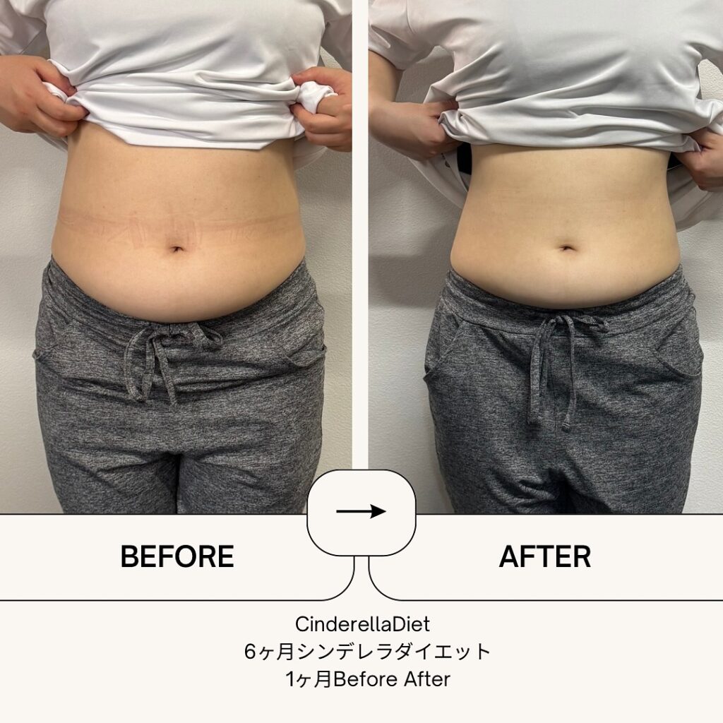 【1ヶ月経過Before After】6ヶ月コースのお客様の比較画像になります️1ヶ月で、体重・・・-8.9kg。